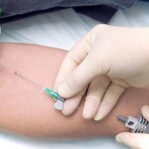 efect butirat asupra organismului, efectele utilizării și tratamentului dependenței (consecințe) efect butirat asupra organismului, efectele consumului de alcool si dependenta de tratament