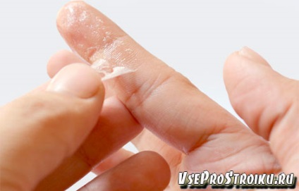 Frecarea adeziv super-cu degetele (degetele de la picioare) Frecarea adeziv super-de pe degete