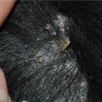 Acanthosis nigricans și complicațiile sale, lumea de medici veterinari (acantoza) acanthosis nigricans și complicațiile sale, lumea de medici veterinari