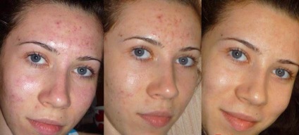 Cleansing faciale - tipuri, metode și caracteristici ale procedurii de curățare () Cleansing faciale - tipuri, tehnici și proceduri în special