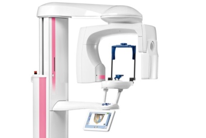 Ce este o tomografie computerizata dentară și în cazul în care acesta este utilizat (tomografie computerizata a dintilor) Ce este o tomografie computerizata dentară și în cazul în care se aplică