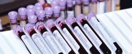 Care este fosfataza alcalină crescută ca vindecarea, cauze, simptome, prevenire, consiliere (alcaline) Care este fosfataza alcalină crescută ca vindecarea, cauze, simptome, prevenire, consiliere