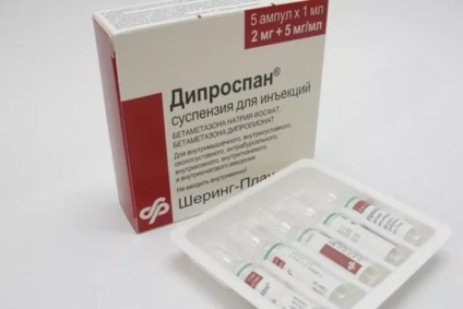 Deformând artroza articulației gleznei - cauze, simptome si tratament (glezna) Deformând artroza articulației gleznei - cauze, simptome și tratament