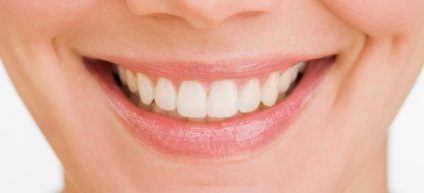 restaurare dentară estetică (restaurare) Restaurare estetică dentară