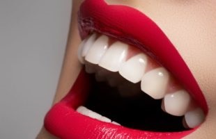 restaurare dentară estetică 1 (estetică) restaurare dentară estetică 1