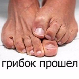 Lactarius descriere galben ciuperca crește în cazul în care modul de preparare (Lactarius) Lactarius descriere galben ciuperca crește în cazul în care modul în care să se pregătească