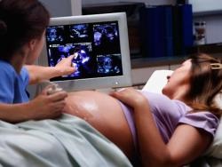 Cum de a ridica placenta in timpul sarcinii (sarcinii creste placenta) Cum de a ridica placenta in timpul sarcinii