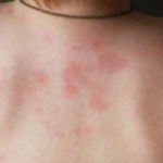 Ca o piele poros liber netezite (piele) Cum pielea netedă poros în vrac