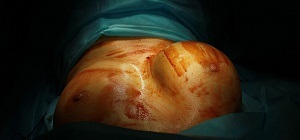 Clinica de Chirurgie Plastica si cosmetologie preturi Moscova, fotografii (cosmetologie) Clinica de Chirurgie Plastica si cosmetologie preturi Moscova, fotografii