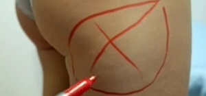 Clinica de Chirurgie Plastica si cosmetologie preturi Moscova, fotografii (orph) Clinica de Chirurgie Plastica si cosmetologie preturi Moscova, fotografii