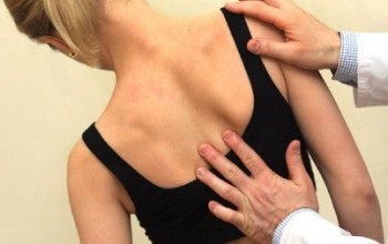 Tratamentul conservator al simptomelor scolioză adult, semne, terapie fizică, chirurgie, profilaxie (adult) Tratamentul conservator scoliozei la simptome adulti, semne, terapie fizică, chirurgie, prevenire