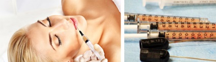 Lipofilling comentarii față, lecturi și perioada de reabilitare, fotografii, preturi (lipofilling) Lipofilling comentarii față, lecturi și perioada de reabilitare, fotografii, preturi