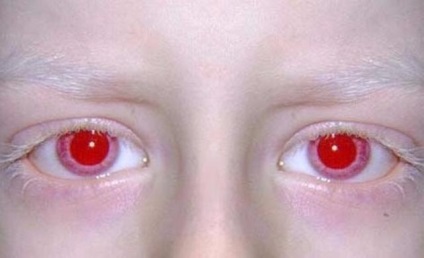 Persoanele cu ochi căprui, mai fiabile, și alte fapte despre culoarea ochilor (ochi) Persoanele cu ochi căprui, mai fiabile, și alte fapte despre culoarea ochilor