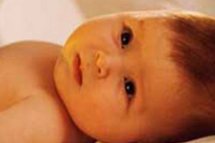 Mycoplasma simptomelor copii și tratament posibil - site-ul pentru copii mici (curgerea nasului, congestie nazală) Mycoplasma simptomelor copii și tratament posibil - site-ul pentru copii mici