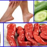 Amortit piciorul (poate produce amorțeală) Numb piciorul