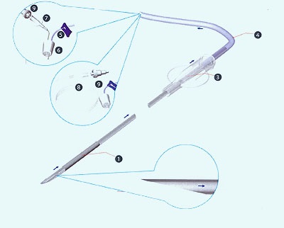 Ltd. - medpostavka-1 (oocitele de prelevare neinvaziv) Oooh - medpostavka-1