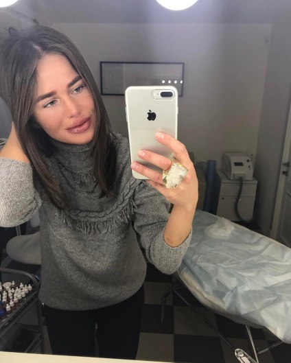 Singer Alex recâștigat buzele pline în stil Jolie (Declarația) Singer Alex recâștigat buzele pline în stilul jolie