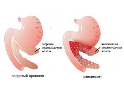 Indicatii pancreatinei tablete (tablete) Indicatii pancreatină tablete