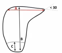 Dimensiunile ficatului si vezicii biliare la ultrasunete (Lecture pe diagnostere)