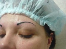 Cum se vindeca sprancene tatuaj (sprancene) Cum se vindeca sprancene tatuaj