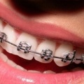 mulaje dentare (ceara) ceară dentară