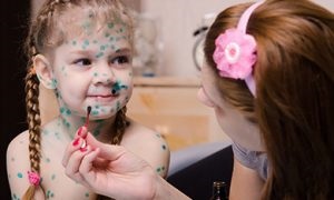 Cabană brânză caserola la grădiniță 4 rețetă pentru cuptor (brânză de vaci caserolă grădiniță reteta delicioasa cuptor pentru stafide grișul calorii secrete clasic) Cabană brânză caserola la grădiniță 4 rețetă pentru cuptor