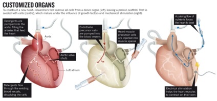 Oamenii de știință au ridicat inima celulelor pielii, futurist - viitorul este deja aici (transplant) Oamenii de știință au ridicat inima celulelor pielii, futurist - viitorul este aici