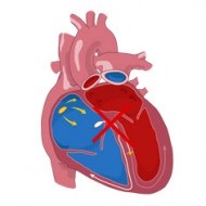 Volumul accident vascular cerebral si ventriculare minut arteriale sistolice la stânga