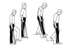 Exercitarea dupa faza de post-operatorie chirurgie de inlocuire a soldului precoce (artroplastie) Exercitarea dupa faza de inlocuire a soldului în perioada postoperatorie precoce