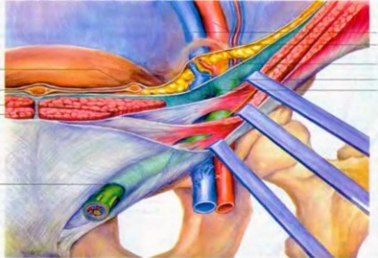 Uzi suprarenale (curs diagnostere) (copii mai mari) Uzi adrenal (Lecture pe diagnostere)