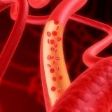 Tipuri de tratamente extracorporale - bisturiu - informare si educatie medicala (tratamente extracorporale) Tipuri de terapii extracorporale - bisturiu - informații medicale și educație