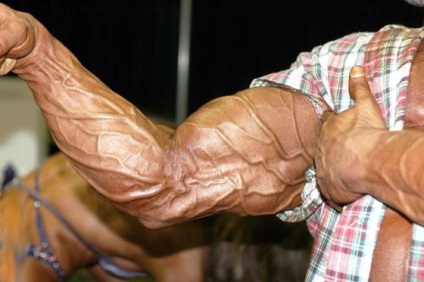 Boxe venele în picioare, brațe, piept cauze ale vaselor de sange umflate (act) Boxe venele în picioare, brațe, piept cauze ale vaselor de sange umflate