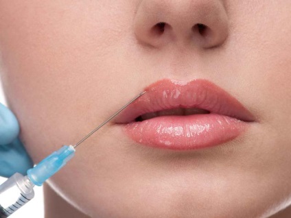 Chiloplasty ce fel de operație, indicații de buze de plastic, avantajele și dezavantajele (indicativ) Chiloplasty ce fel de operație, indicații pentru buze din plastic, avantaje și dezavantaje