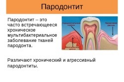 Tratamentul cronic al periodontitei (boala parodontala) Tratamentul parodontita cronică
