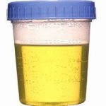 Mirosul de urină de pisică și cum să scape de covor, canapele si alte piese de mobilier și suprafețe în casa (urină de pisică scăpa) Mirosul de urină de pisică și cum să scape de covor, canapele si alte piese de mobilier și suprafețe de uz casnic