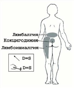 Teribil de dureri de spate mai mici și renunță, decât pentru a trata (picior) Teribil de dureri de spate mai mici și renunță, decât pentru a trata