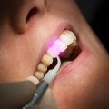 Periuță de sfatuieste cum sa alegi un medic dentist (periuta de dinti electrica pentru copii cum de a alege cu ultrasunete) Periuță de sfatuieste cum sa alegi un dentist
