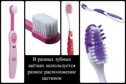 soi periuță de dinți și reguli de alegere (reguli) soi periuta de dinti si reguli de alegere