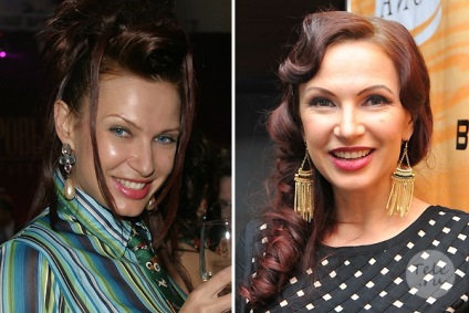 stele română show business, care nu ascund ceea ce fac din plastic, frumusete, viata sanatoasa (Taisiya Povaly) stele română show business, care nu ascund ceea ce fac din plastic, frumusete, viata sanatoasa