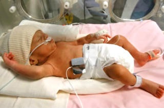 Защо има апнея при новородени - причини и симптоми