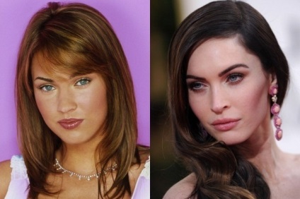 Megan Fox - toate fotografiile de chirurgie plastică înainte și după