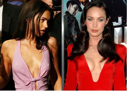 Megan Fox - toate fotografiile de chirurgie plastică înainte și după