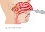 sulfonilureice