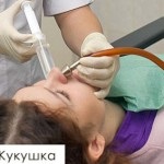 назален процедура промивка кукувица в синус