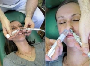 Процедурата с миенето на носа в синусите - кукувица видео техника и мнения