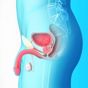 complicatii adenomul de prostata dupa operatie si participatia (adenom) chirurgie HBP și complicații după conferința
