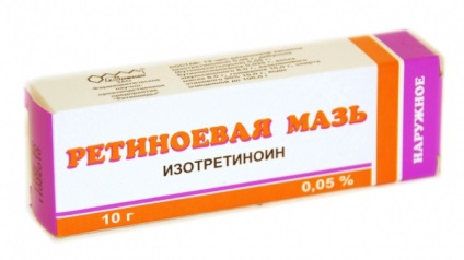 psoriazis Arthropathic - Simptome si tratament (simptome) Artropaticheskom - Simptome si tratament