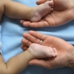 displazia acetabulara a soldului (displazie) displazie acetabulară a articulațiilor șoldului