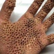Bacteriile și algele sunt diferențele și asemănările ca înmulțirea și furaje (alge) Bacteriile și algele sunt diferențele și asemănările, ca rasa, și ce să mănânce
