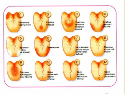Limba albă a copilului - cauzele, simptomele si tratamentul bolilor